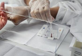 Carnaval seguro: SESAB instala postos de testagem e distribuição de camisinhas